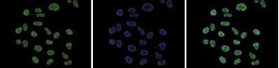 Immunofluorescence: Histone H3 [ac Lys18, Dimethyl Arg17] Antibody [NBP2-59217]